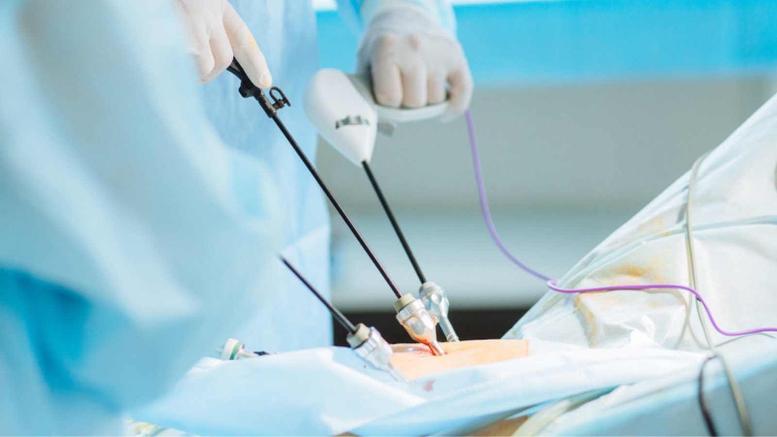 monoisoikhopgoibaonhieutienhuongdanluachoncosouytin1651cb709f2