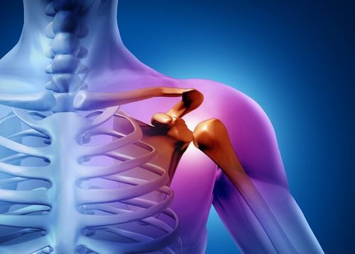 Đau vai: viêm gân chóp xoay, viêm quanh khớp vai, vai đông cứng