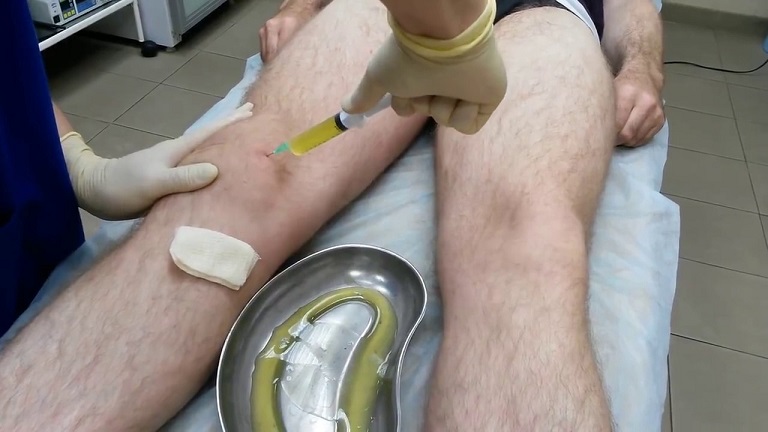 ky-thuat-choc-hut-dich-khop-goi