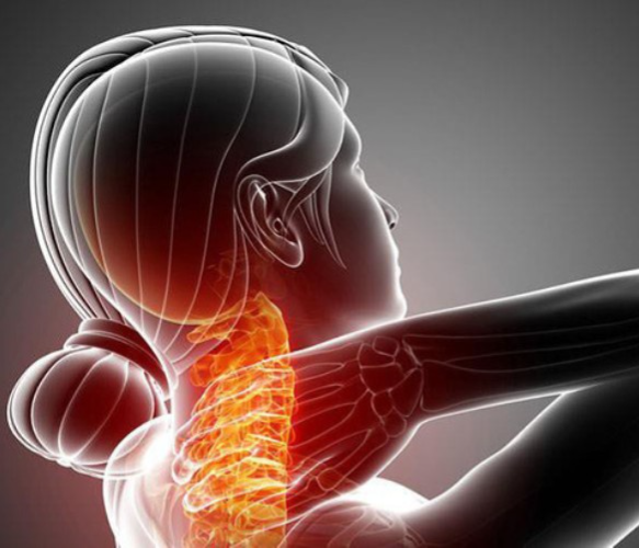 Đau cổ vai gáy, vẹo cổ cấp, co cứng cơ cổ