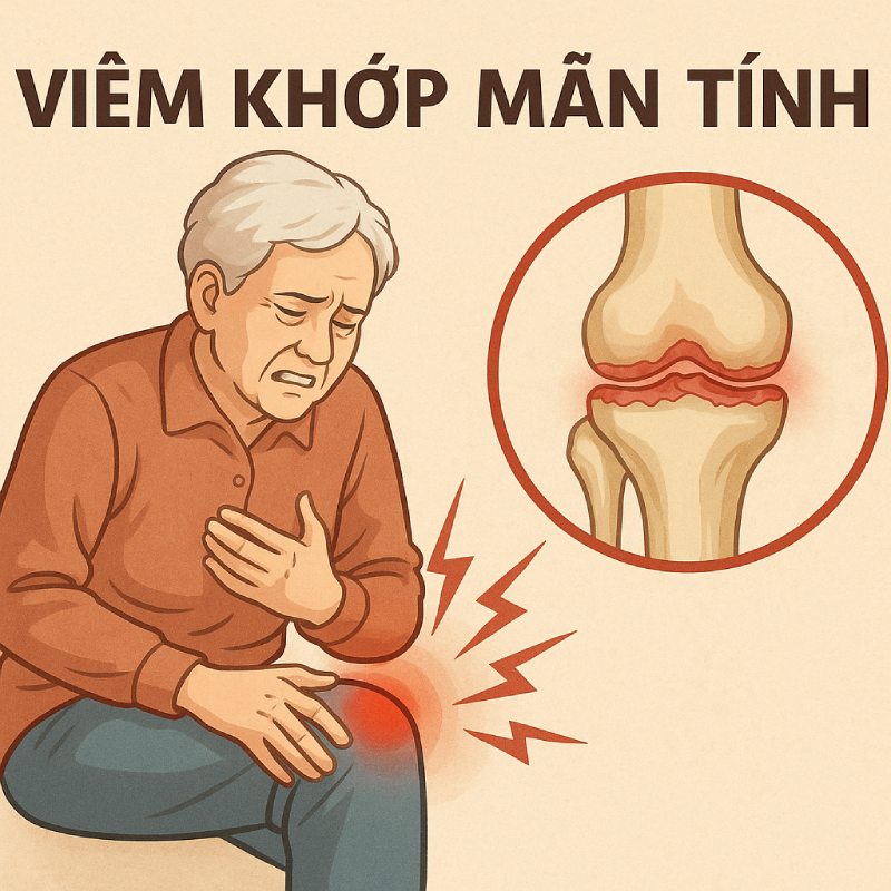 viem-khop-man-tinh